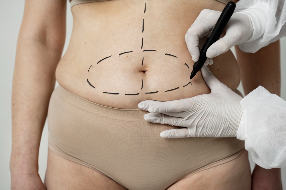How much weight can you lose with liposuction?