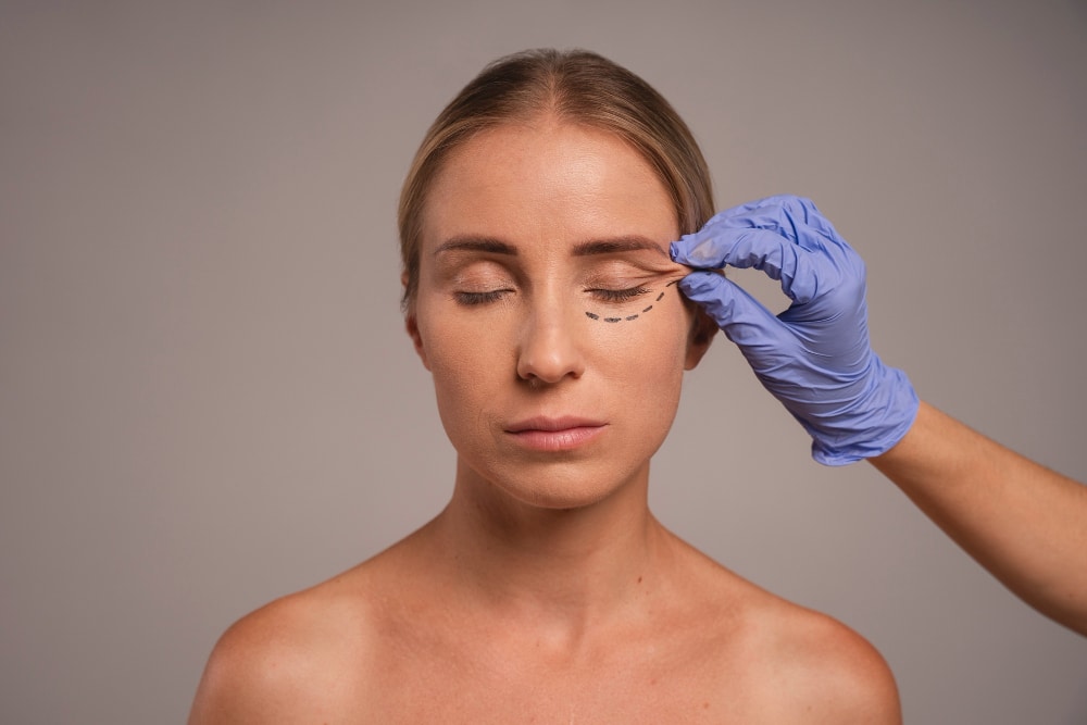 A Complete Guide to Eye Bag Removal Surgery
