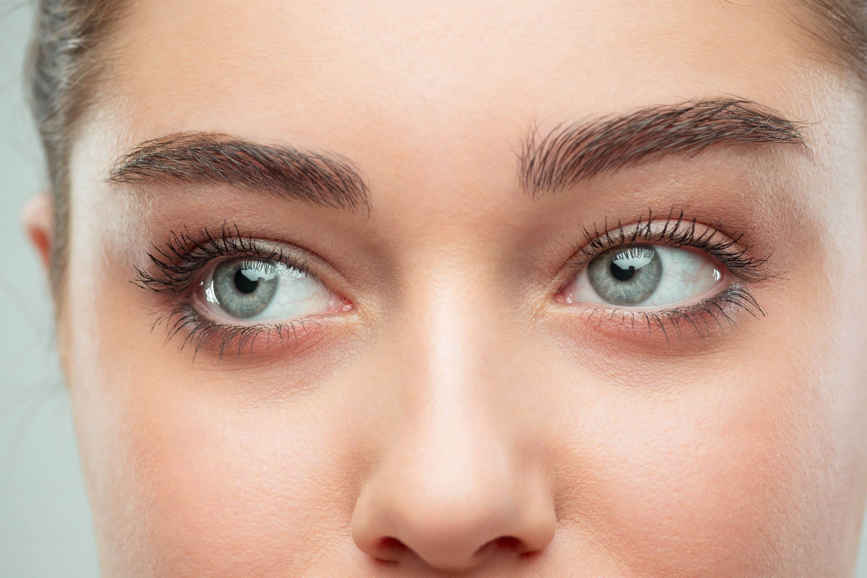 Is eyelid surgery worth it?
