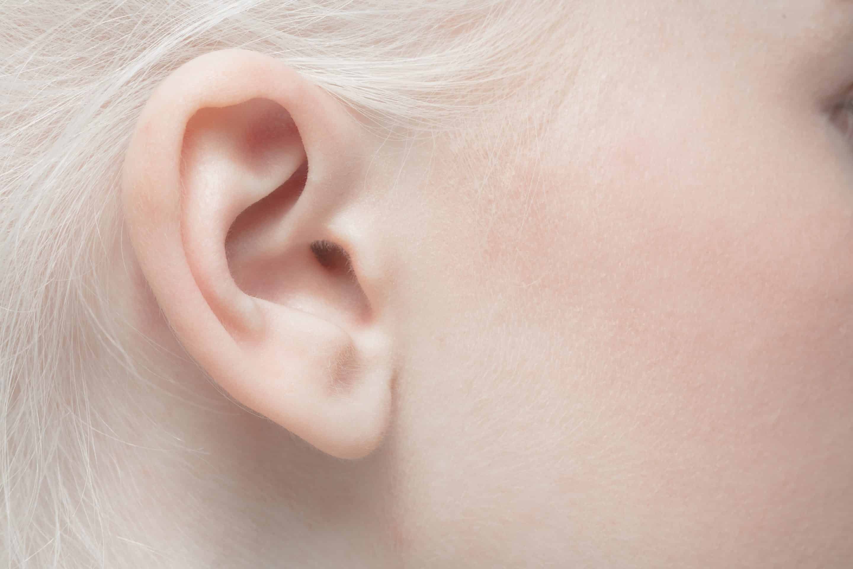 Is Ear Pinning Right for You? Understanding the Benefits of Otoplasty