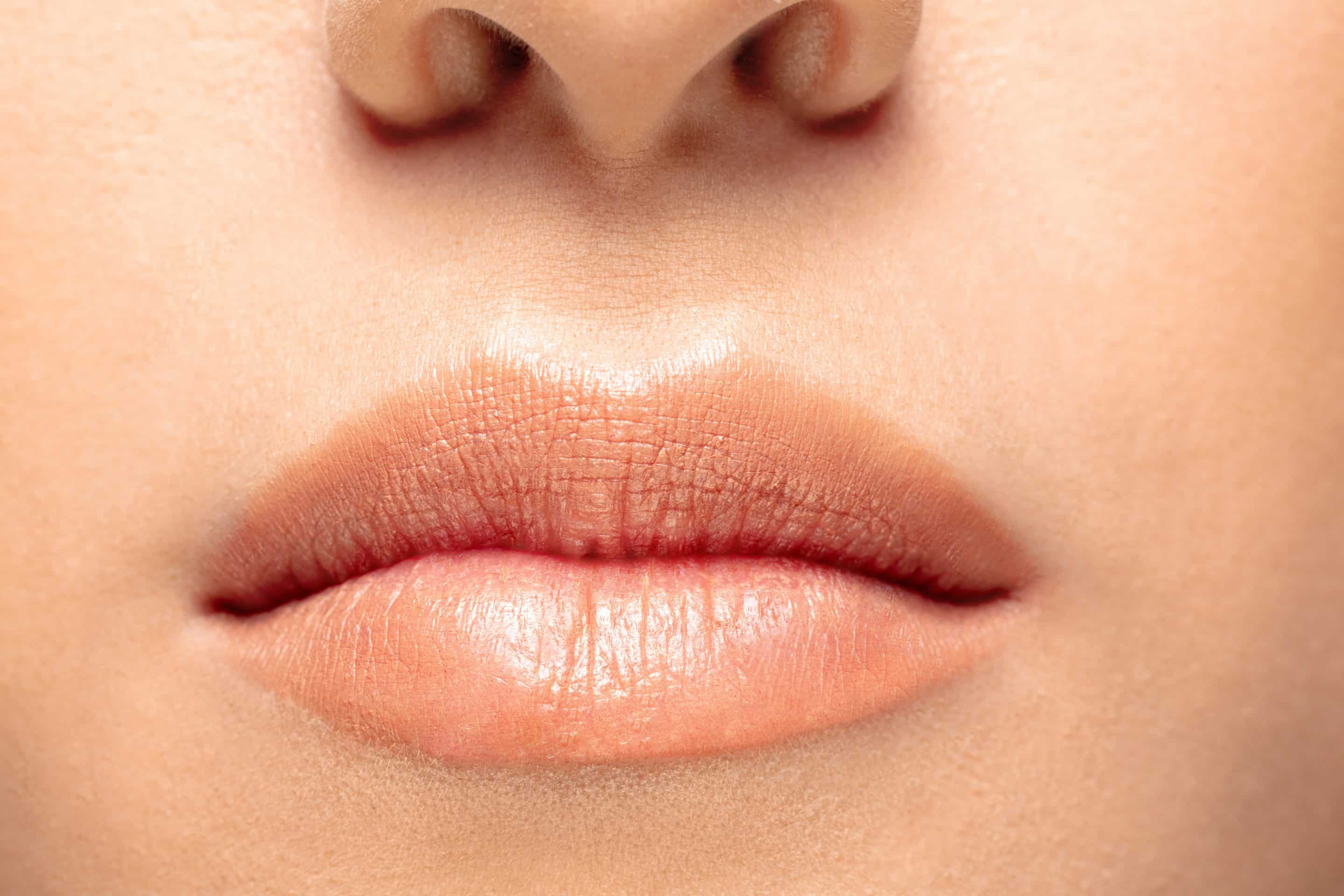Lip Lift vs. Fillers: Which is Right for You?