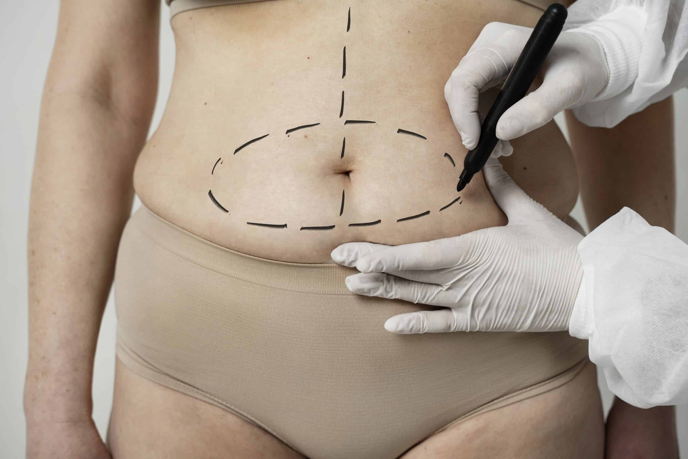 Alleviating Your Fears About Plastic Surgery