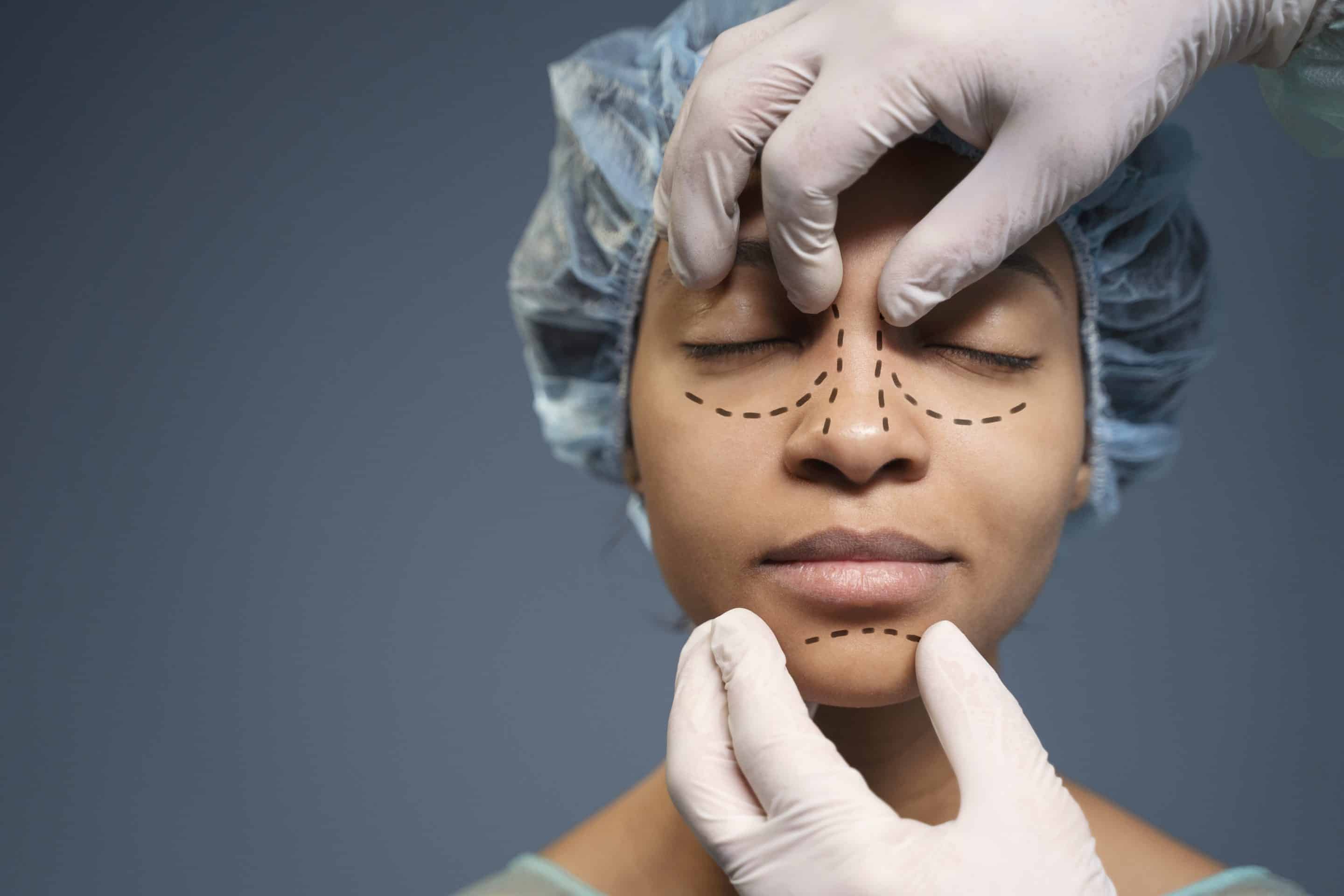 Rhinoplasty swelling stages and recovery