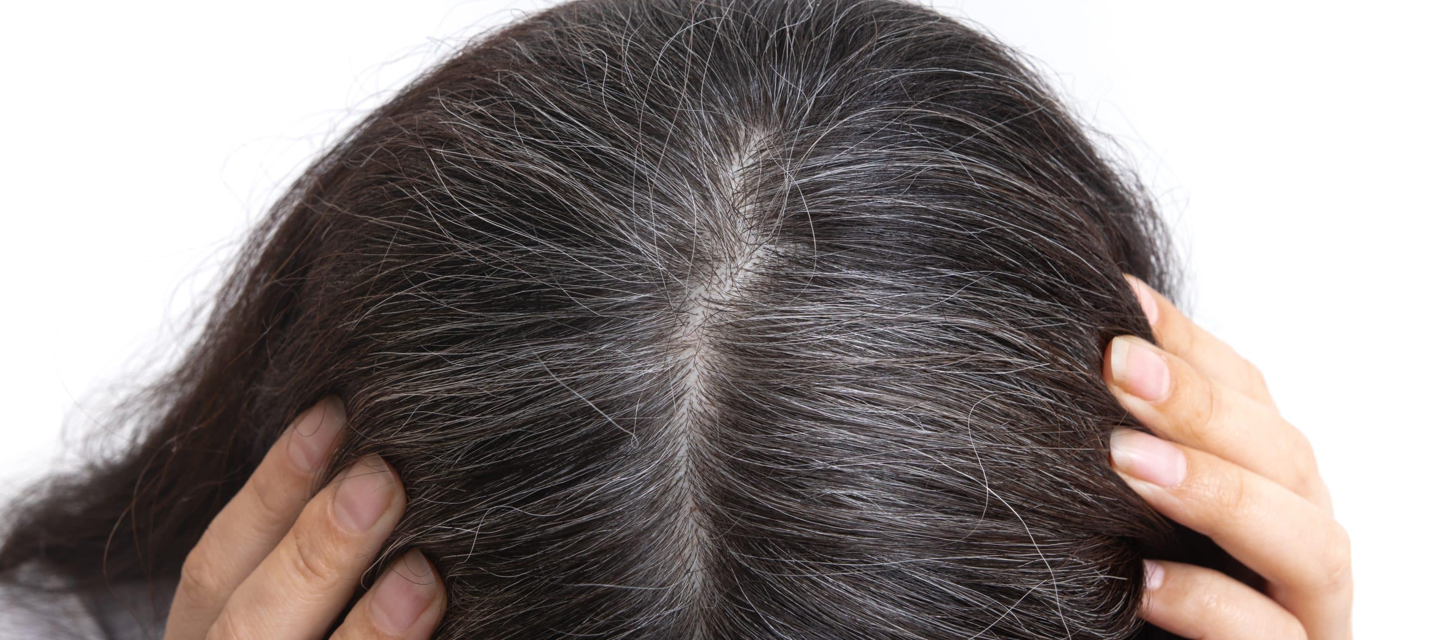 What are Keravive Scalp Treatments